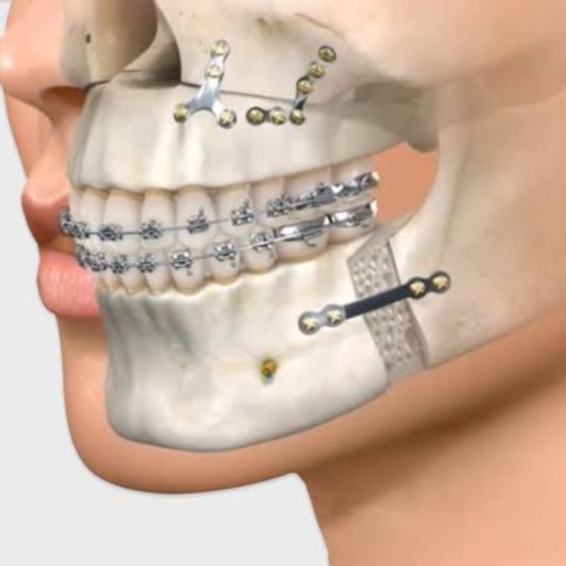 Reconstructive Surgery in Bhagalpur