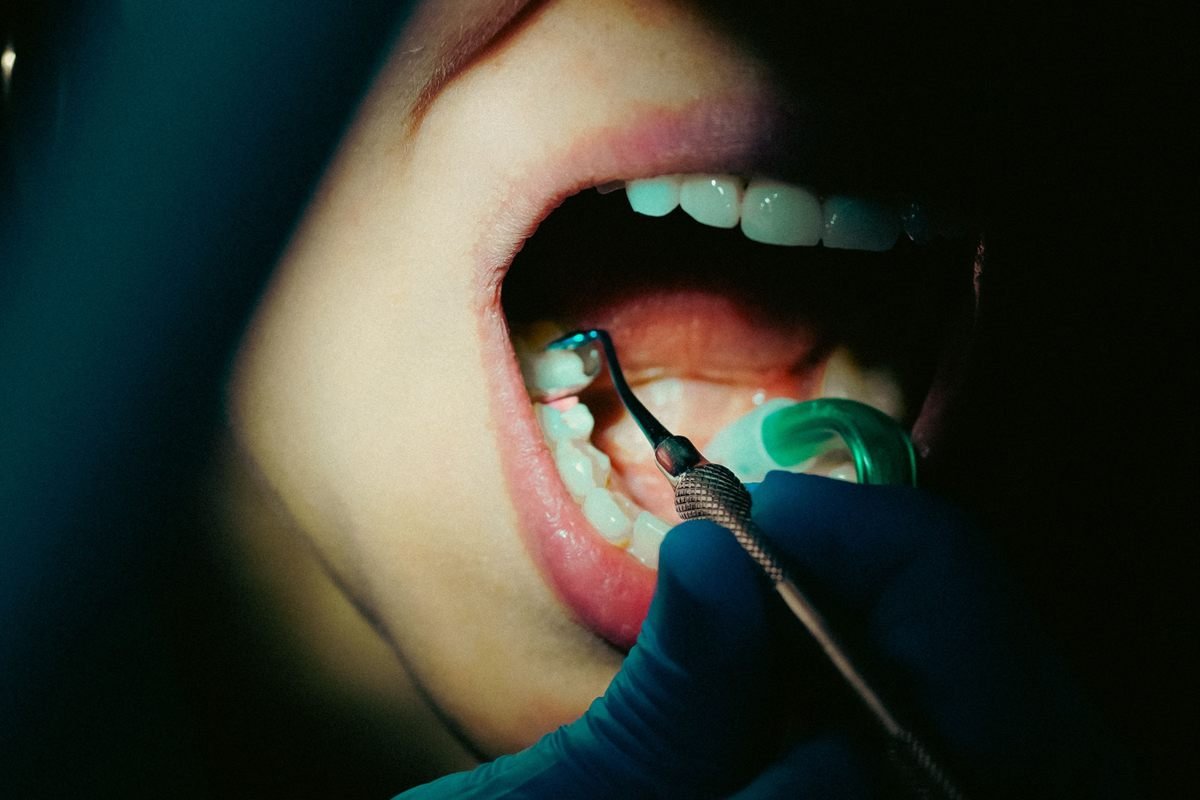 Oral Cancer — Diagnosis & Surgical Treatment at Khushi Dental Care