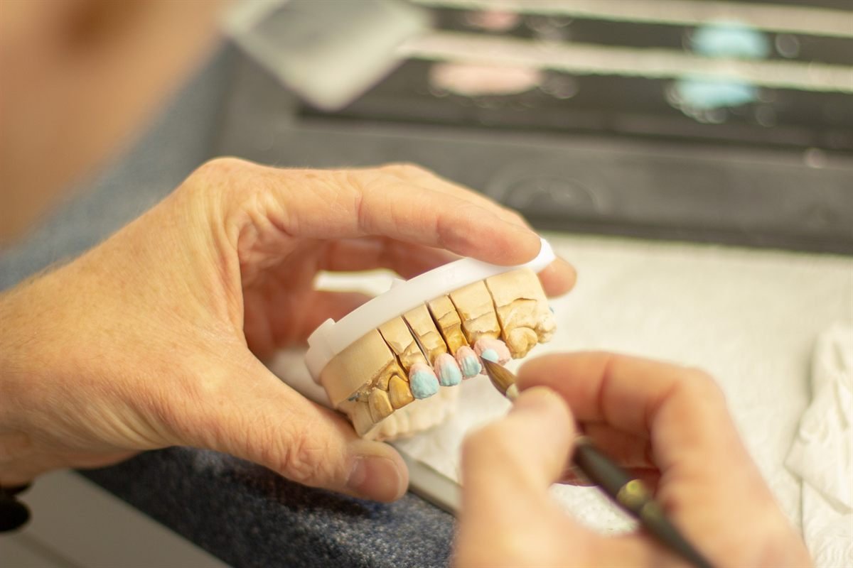 Dentures & Prosthetics at Khushi Dental Care