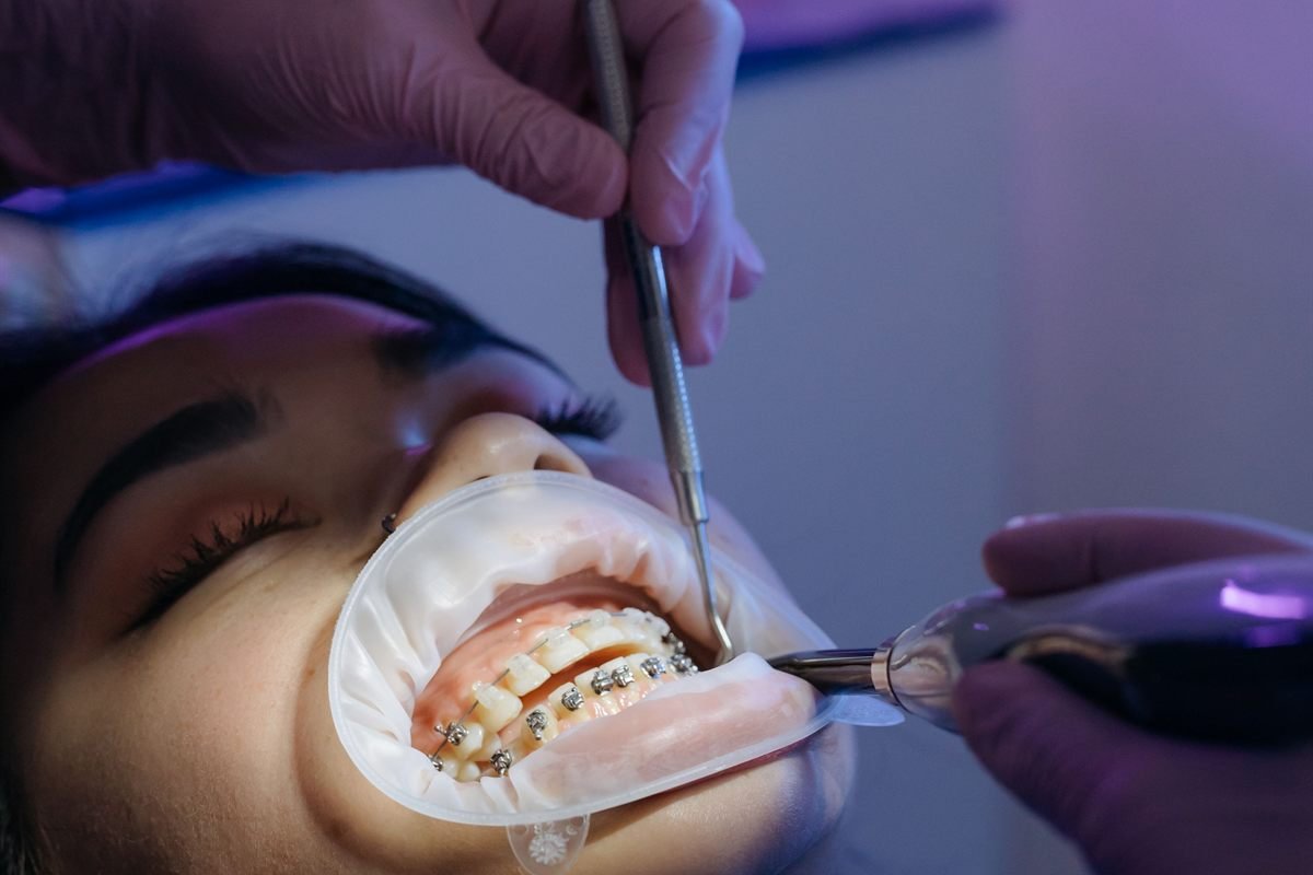 Orthodontics at Khushi Dental Care